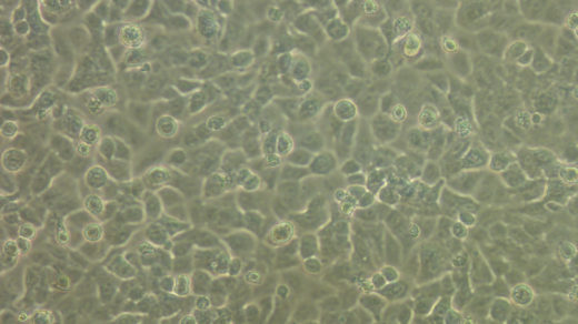 Untreated human lung cancer cell. A549.