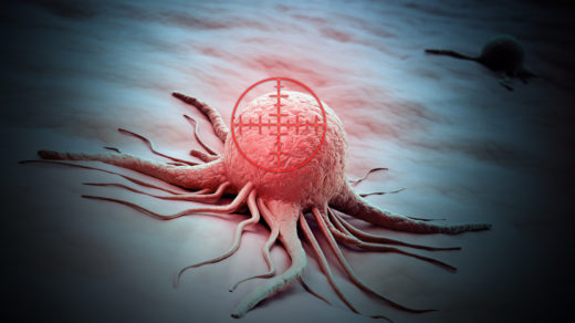 PDT Targets Breast Cancer Using Nanoparticles to Deliver Photosensitizers Oncotarget Impact Journals