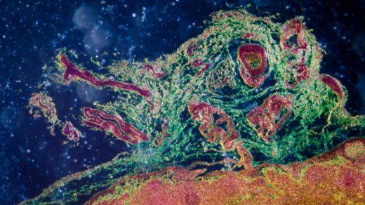 Oncotarget lymph