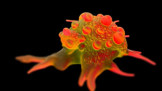 3d Illustration of Bladder Cancer cell