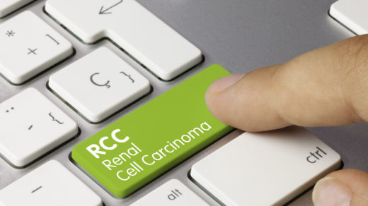 RCC Renal Cell Carcinoma Written on Green Key of Metallic Keyboard. Finger pressing key.