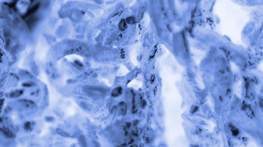 PC-3 human prostate cancer cells stained with blue Coomassie, under a differential interference contrast microscope.
