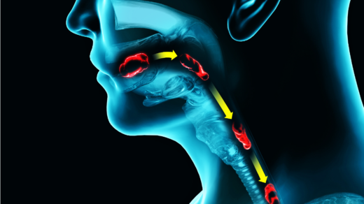 Nimotuzumab Improves Non-HPV Oropharynx Cancers