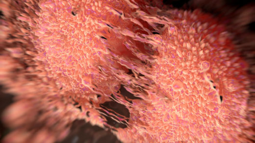 Cancer cell division of two prostate cancer cells in the final stage of cell division (cytokinesis) cytoplasm divides. the cells are joined by several thin cytoplasmic bridges. They to form tumours