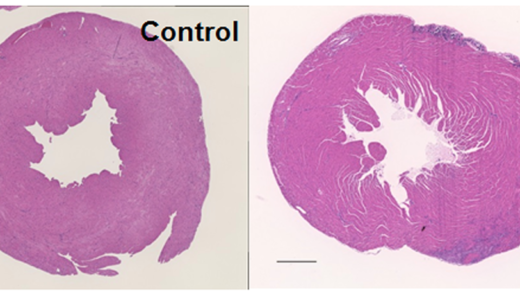 Part of Figure 2: Alterations in the myocardium of CT26-inoculated BALB/c mice.