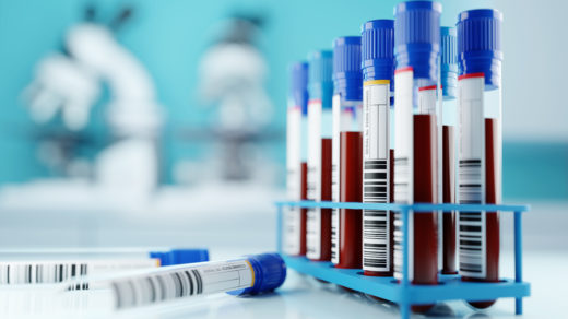 A set of human blood samples in a medical laboratory.