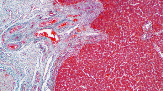 Human liver tissue under the microscope view.