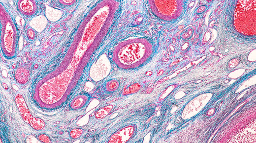 Anatomy and physiology of Ovary under the microscopic in laboratory.