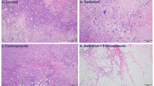 Acid Reflux Drug Exhibits Anticancer Activity