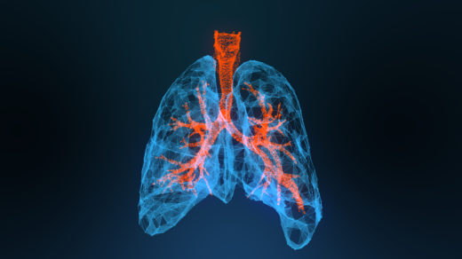 3D rendered illustration of lung cancer