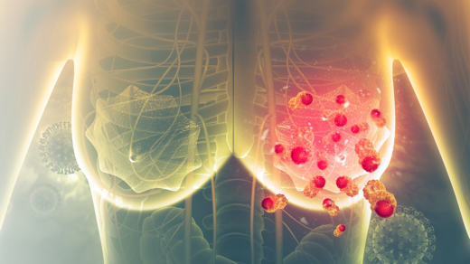 Breast cancer illustration