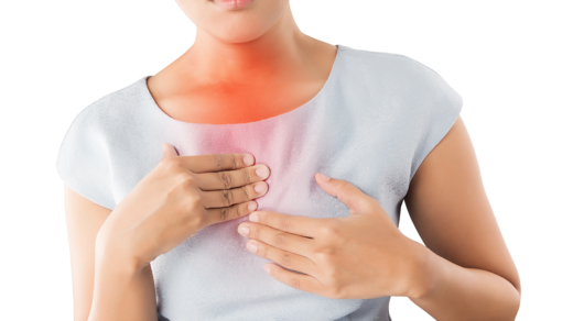Heartburn Acid Reflux