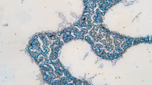 Saccharomyces cerevisiae