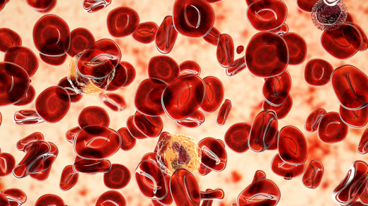 Synergy of HDACi, PARPi and Chemotherapeutics Against Blood Cancer
