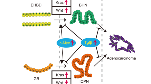 Figure 1: The role of Kras and canonical Wnt pathways for tumorigenesis of extrahepatic biliary system.