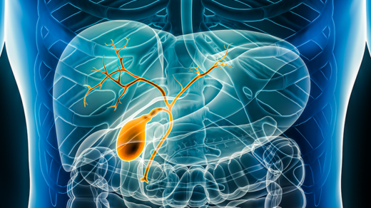 p53’s Protective Role in Extrahepatic Biliary Precancerous Lesions
