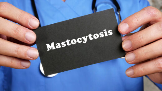 Health care concept about Mastocytosis with inscription on the piece of paper.