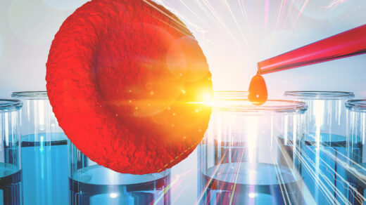 allogeneic hematopoietic stem cell transplantation