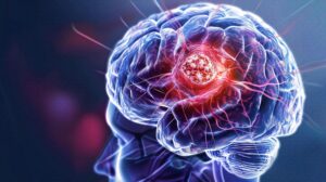 Glioma: Primary Brain Tumor and Spinal Cord Glioma Classification, Imaging Diagnosis, Neurosurgical Treatment, Chemoradiation and Targeted Therapy for Neuro-Oncology Research