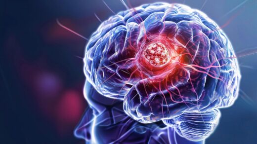 Glioma: Primary Brain Tumor and Spinal Cord Glioma Classification, Imaging Diagnosis, Neurosurgical Treatment, Chemoradiation and Targeted Therapy for Neuro-Oncology Research